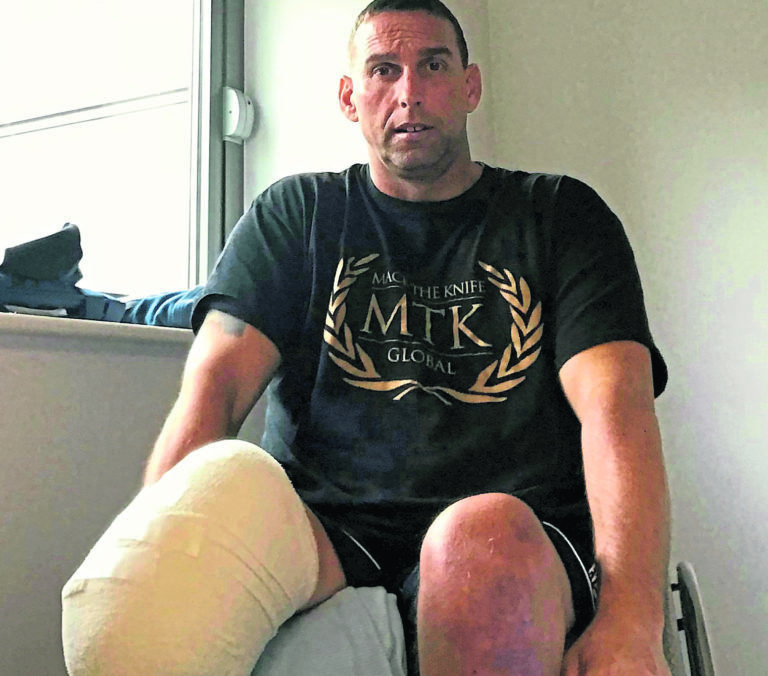 Wheelchair climber needed leg amputated after Ben Nevis accident