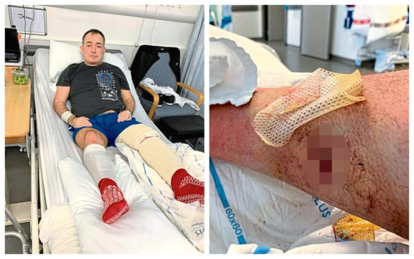 James Nicol was attacked by the dogs after entering a friend's flat.