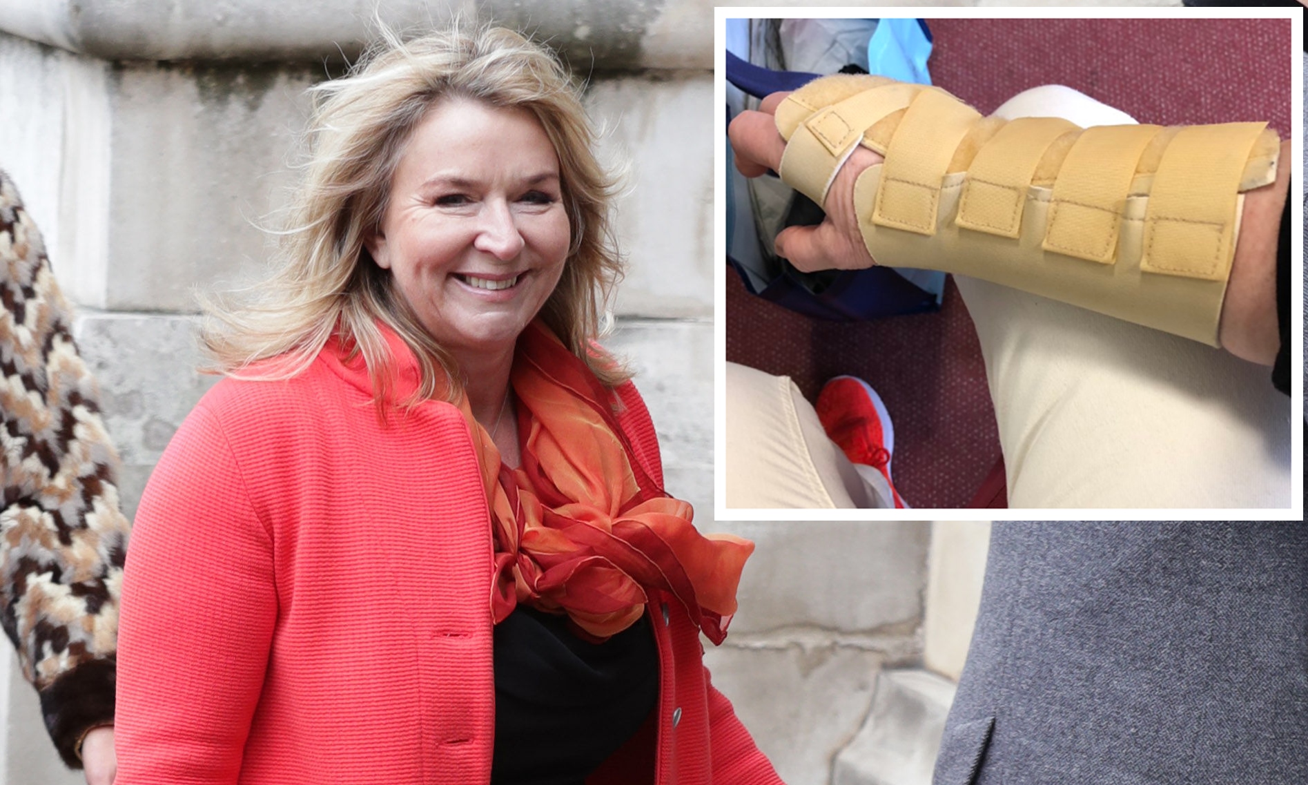 Fern Britton and (inset) a photo she posted of her sore arm.