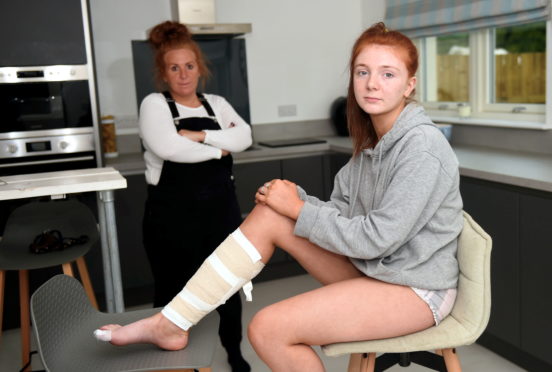 Mum Lyndsay Fleming and teenager Lois Fleming.