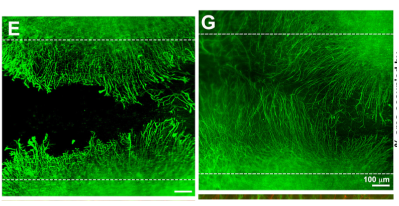 Neuronal growth before, left, and after, right, the team's treatment