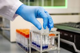 Test tubes with samples of blood being tested for Covid-19 coronavirus in the Microvida laboratory at the Bravis hospital in the Netherlands.
Picture by Robin Utrecht