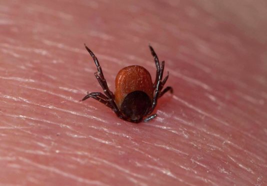 Tick (Acarina sp.) adult, feeding, on human skin