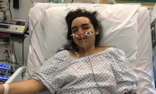 Millie Nicoll, now 19, from Aberlour, Moray, received a life-saving liver transplant.