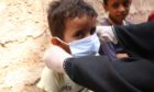Child wearing mask in Yemen.

Disasters Emergency Committee (DEC)

Submitted 28/02/21

 Covid-19 pandemic pushing fragile countries toward 'catastrophe' as cases and deaths go 'chronically underreported'
 Image from

- Community health volunteer teach kids how to wash hands and practice good hygiene to stay healthy