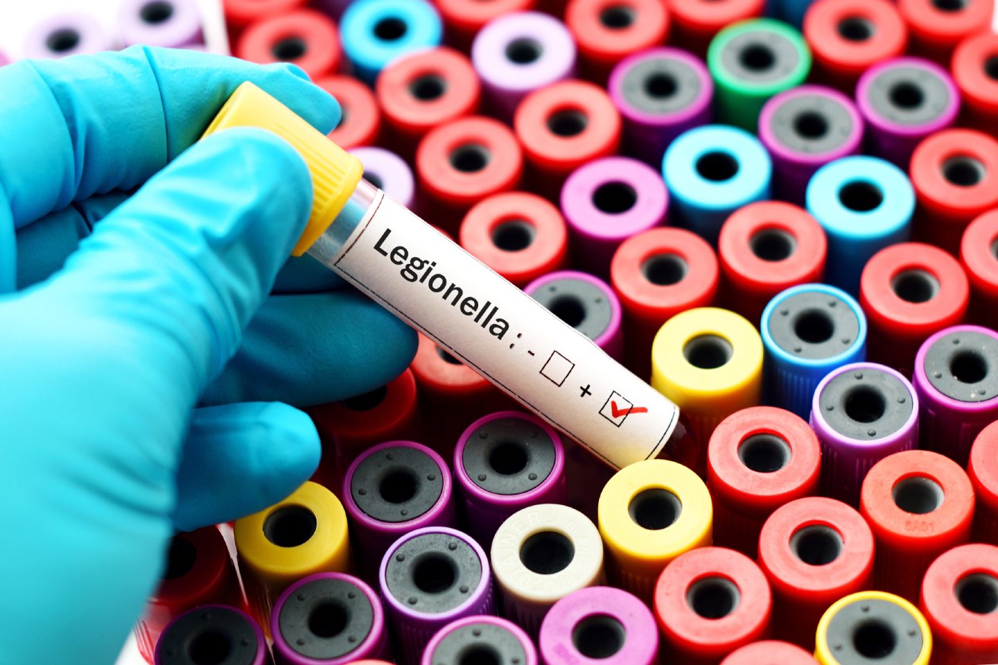 Legionella was detected at Peterhead Community Hospital.