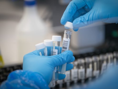 The UK’s coronavirus testing system for travellers could ‘buckle’ when foreign holidays resume, a consumer group has warned (Jane Barlow/PA)