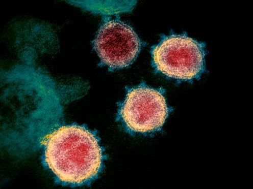 The virus that causes Covid-19 (NIAID-RML via AP, File)