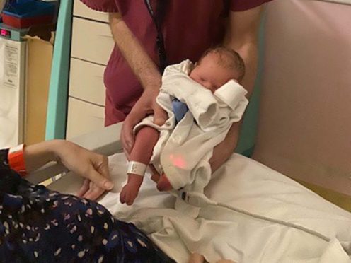Mila can move her legs and is fully continent as a result of the surgery (NHS England/PA)