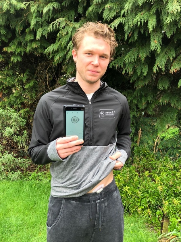 Gavin wearing the Dexcom G5 Mobile, a continuous glucose monitoring system.