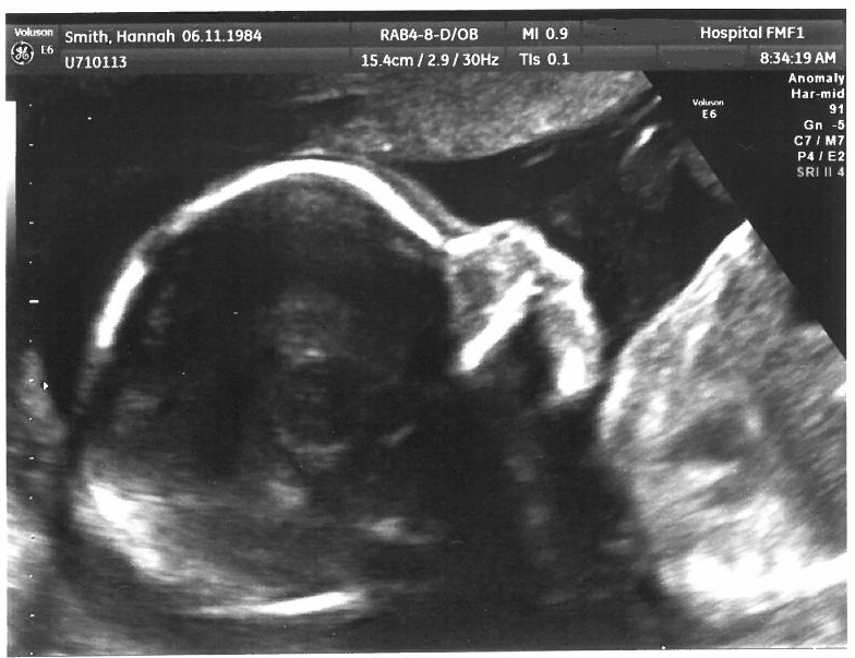 20 week scan (Darryl Smith)