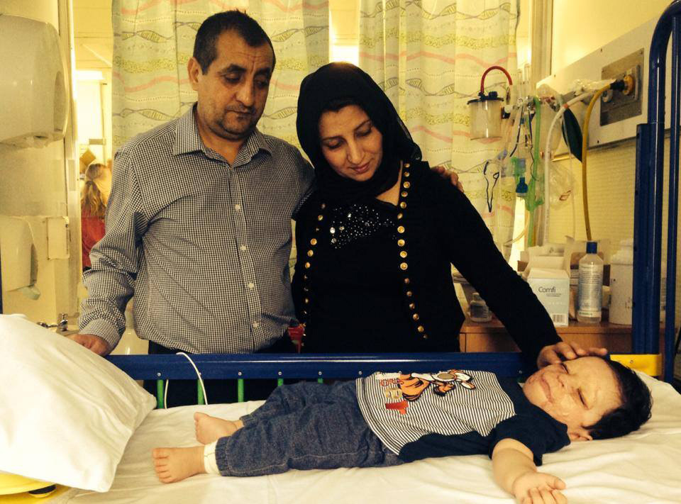 Mohammad Sudais was badly burned in a gas explosion