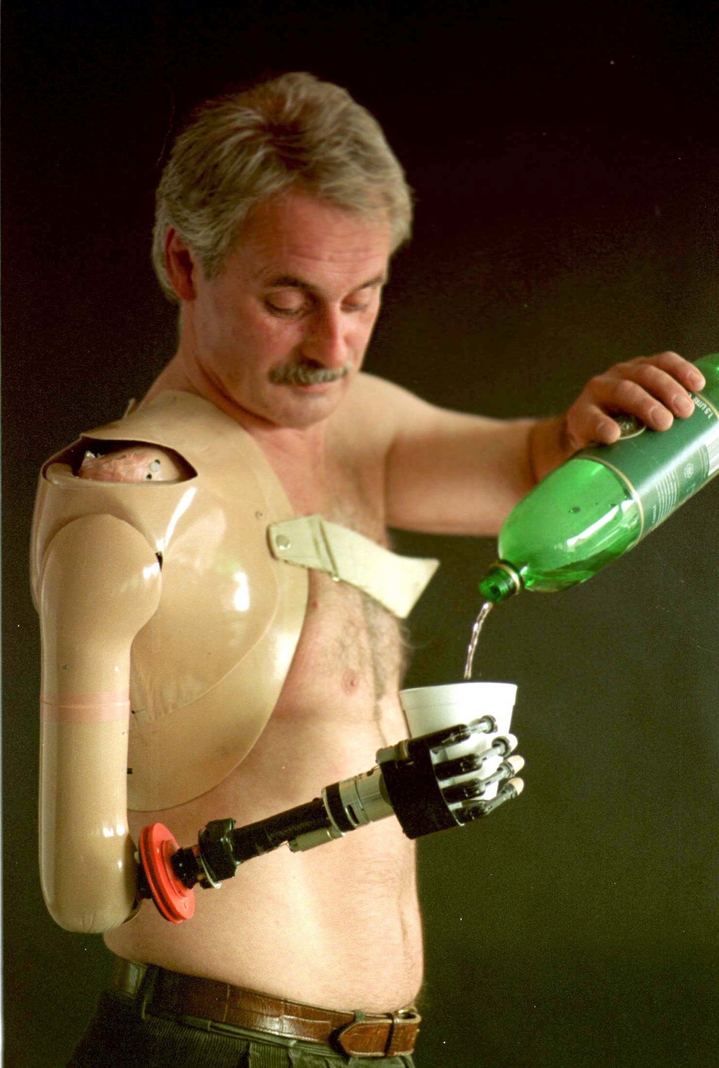 Campbell Aird, 47, a hotelier from Dumfries and Galloway, who has become the first person in the world to use a bionic arm (David Cheskin)