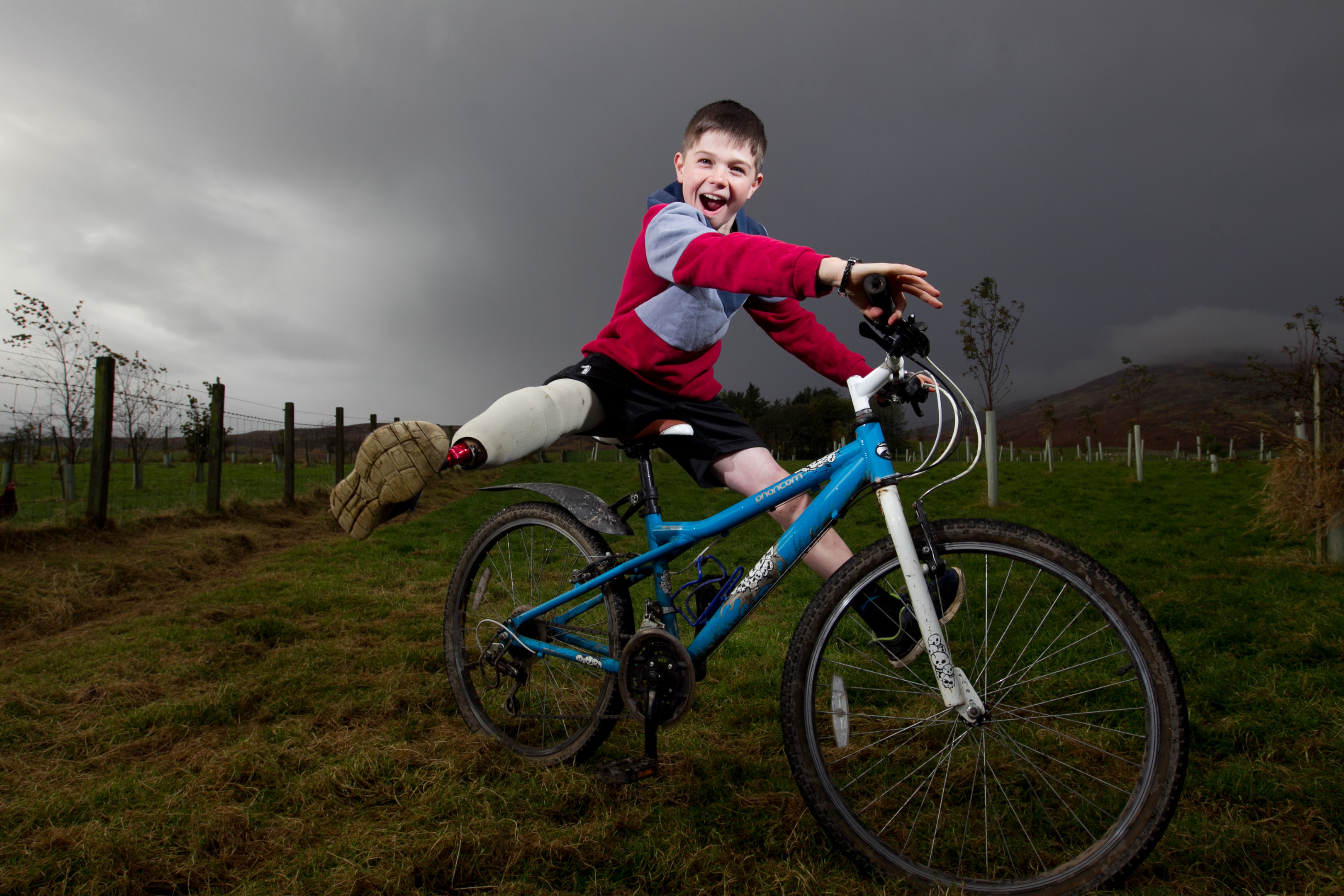 Lewis Kelly lost his leg after an accident on his family farm (Andrew Cawley / DC Thomson)