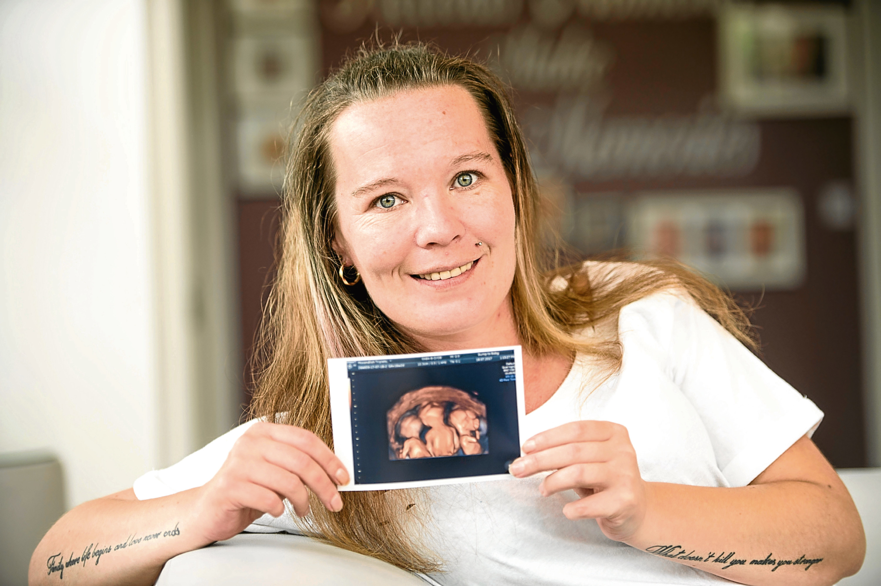 Mother of four Mary McCandlish (34) was today (Friday) having a check up scan at Bumptobaby in Glasgow to see the progress on her triplets (Wattie Cheung)