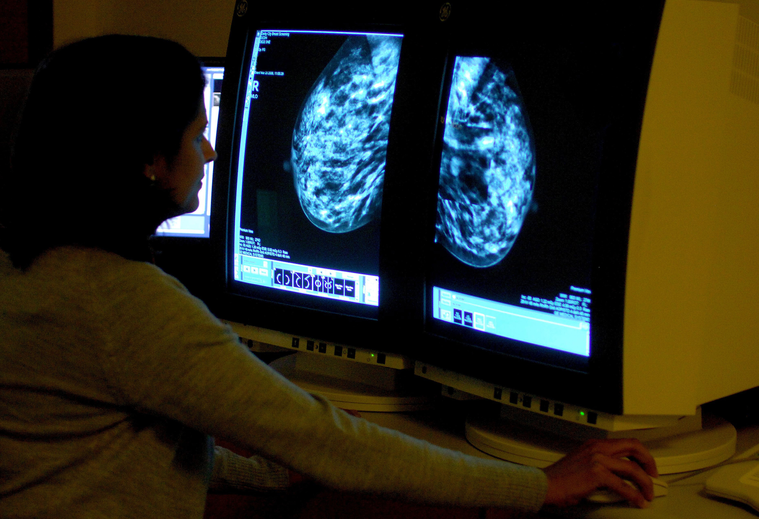 Analysis by Macmillan Cancer Support shows there were 361,216 cancers diagnosed in 2014 in the UK, the most recent figures available, compared to 289,841 marriages. (Rui Vieira/PA Wire)