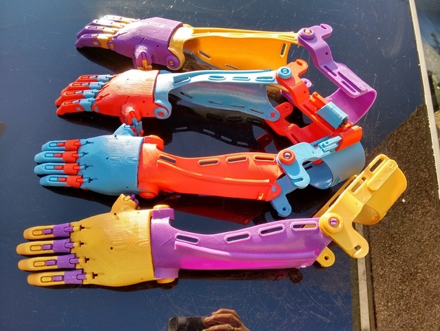 Steve creates the prosthetic hands and arms for kids for free (Team Unlimbited)