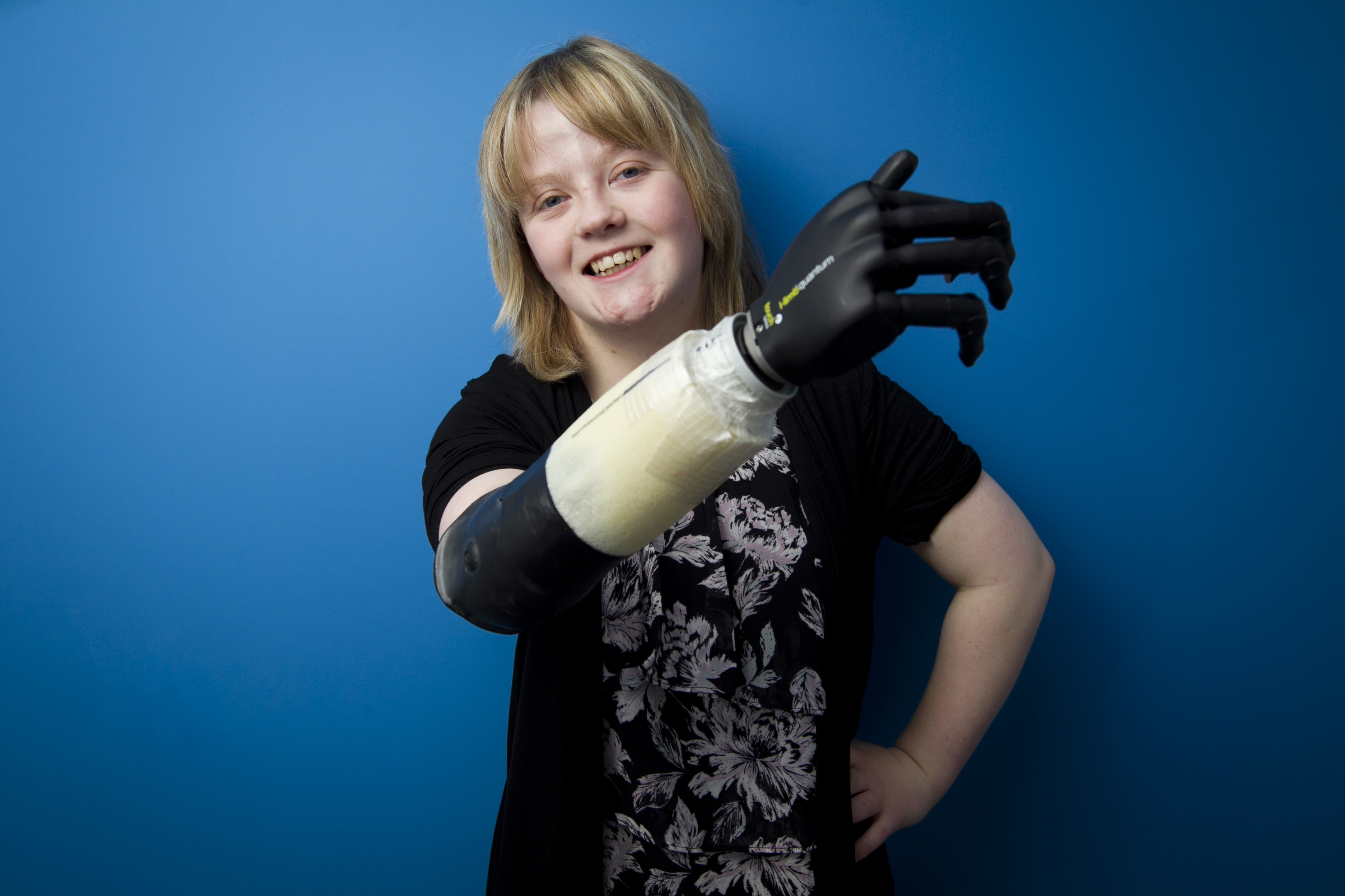 Lorna Kemp (17), with her new prosthetic, by Brian Maguire of VioCare. (Andrew Cawley, DC Thomson)