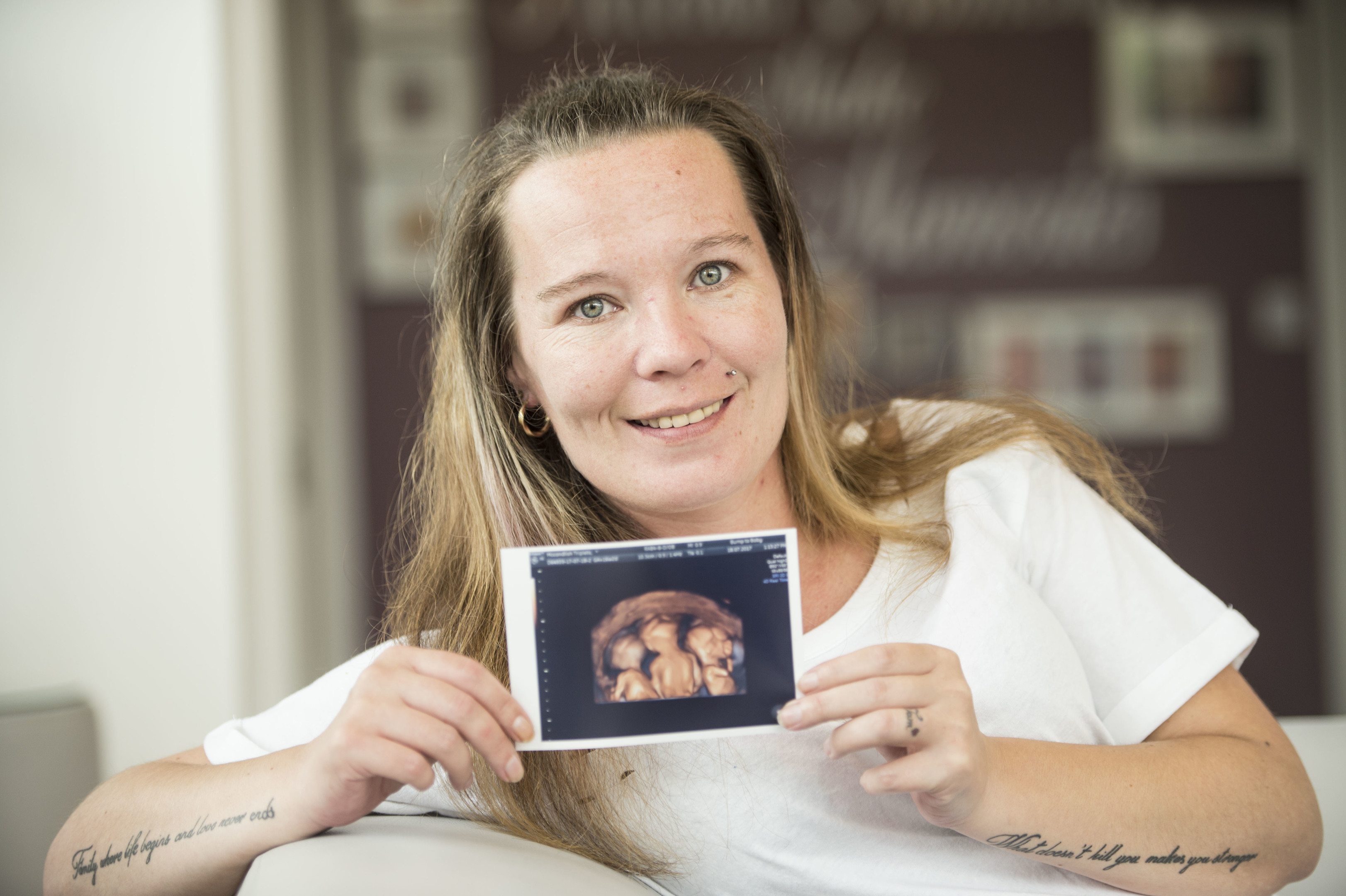 Mary McCandlish (34) gave birth to triplets two weeks ago (Wattie Cheung)