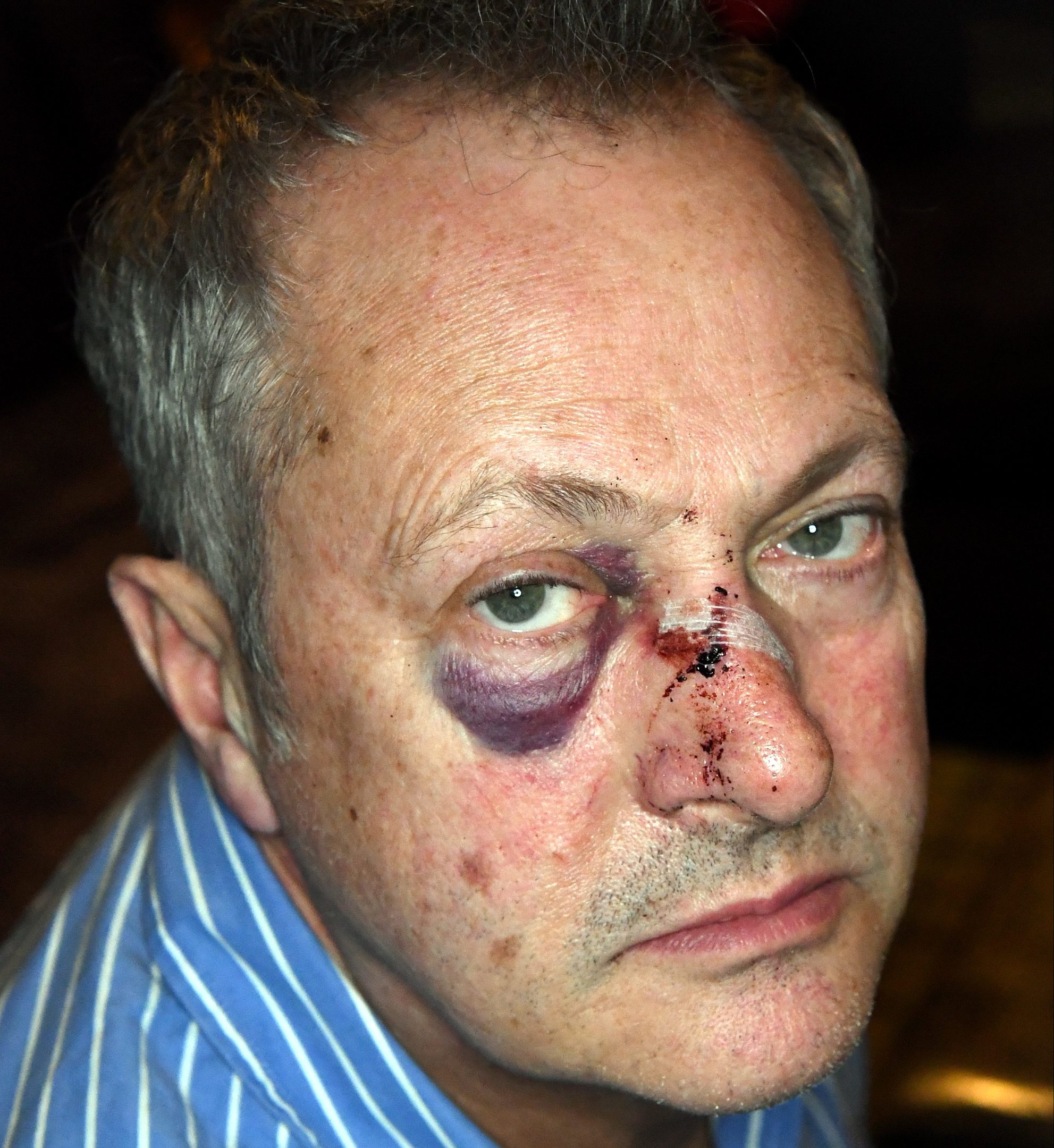 Chef Nick Nairn who was attacked on Union Street last night walking home from his cook school. (Kami Thomson)