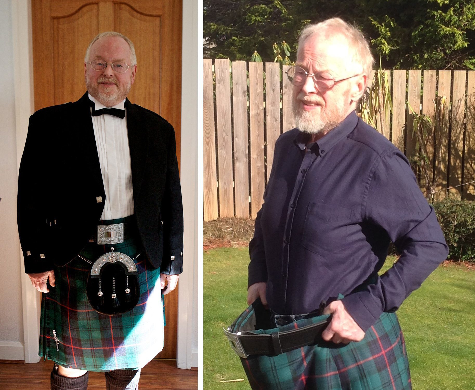 Type 2 diabetes patient, Ian Armstrong, 71, from Eaglesham, East Renfrewshire in July 2013 (left) and March 2017. Weight loss programmes for type 2 diabetes may be more effective than drugs for some patients, a new study suggests (University of Glasgow /PA Wire)