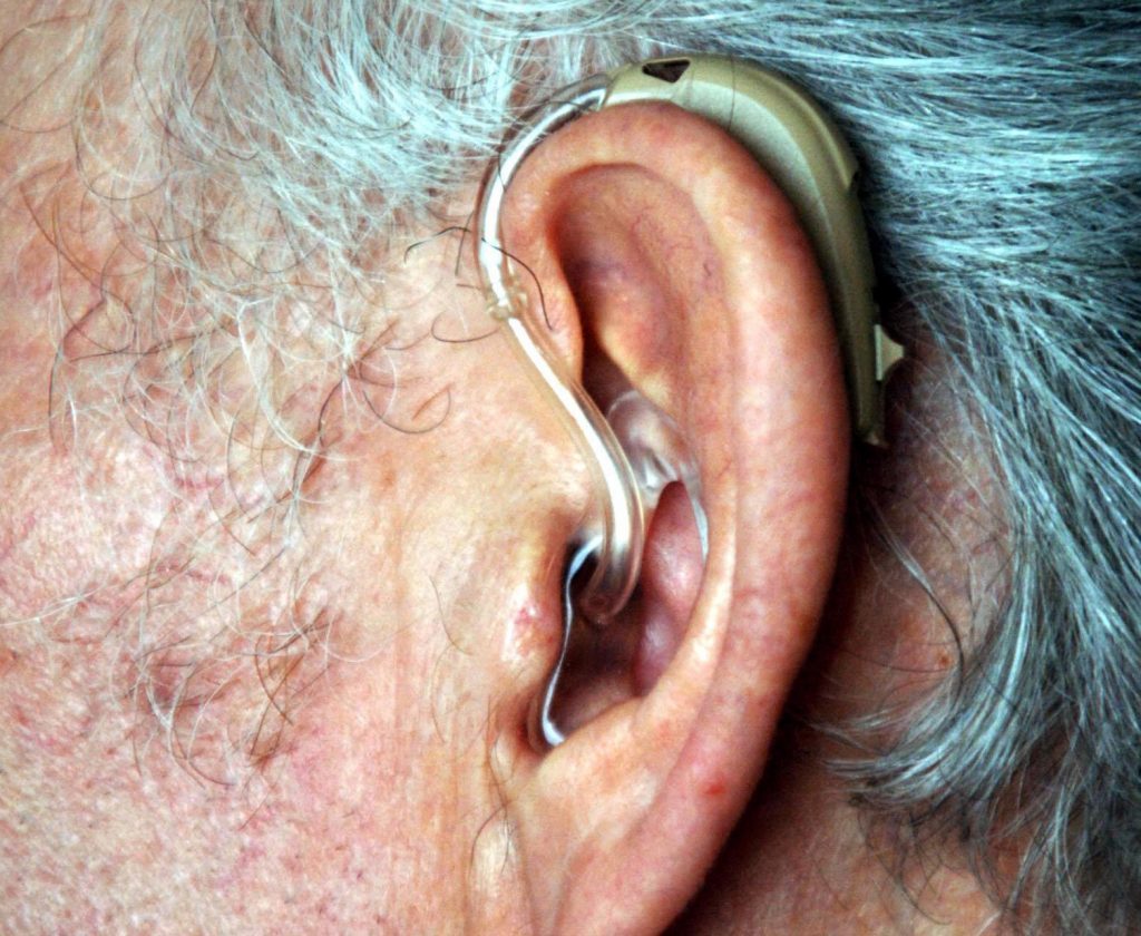 Action on Hearing Loss surveyed more than 1,000 British adults with deafness or hearing loss and found that 54% had worked for some time without disclosing their hearing loss. (Sean Dempsey/PA Wire)