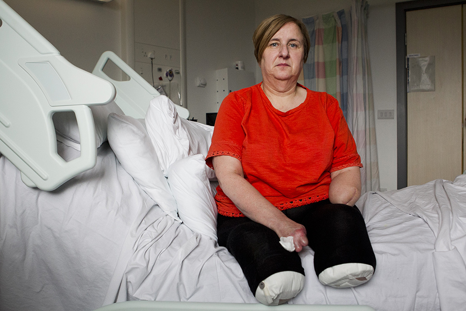 Marguerite Henderson, who has had both her feet and hands amputated (Andrew Cawley / DC Thomson)