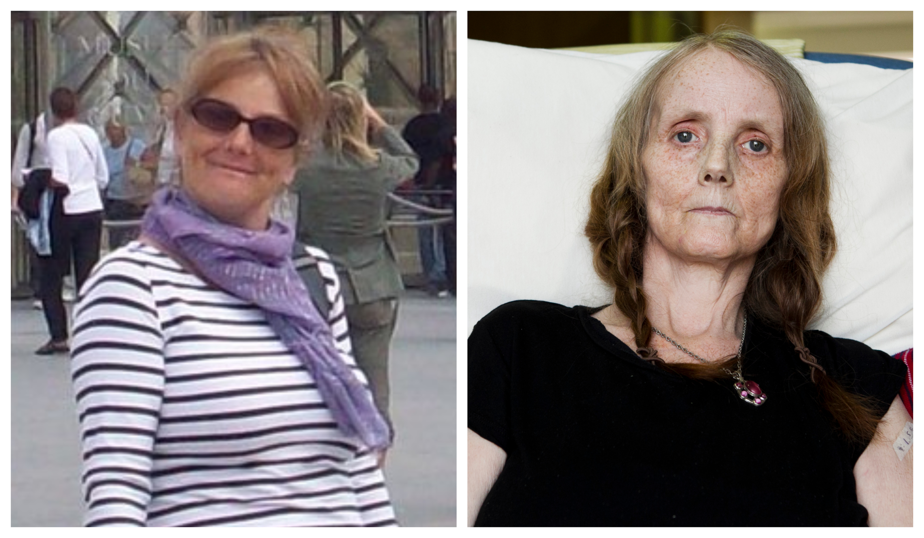 Michelle McDougall on a trip to Paris in 2008 before her diagnosis with a rare cancer (left) and last week in a hospice