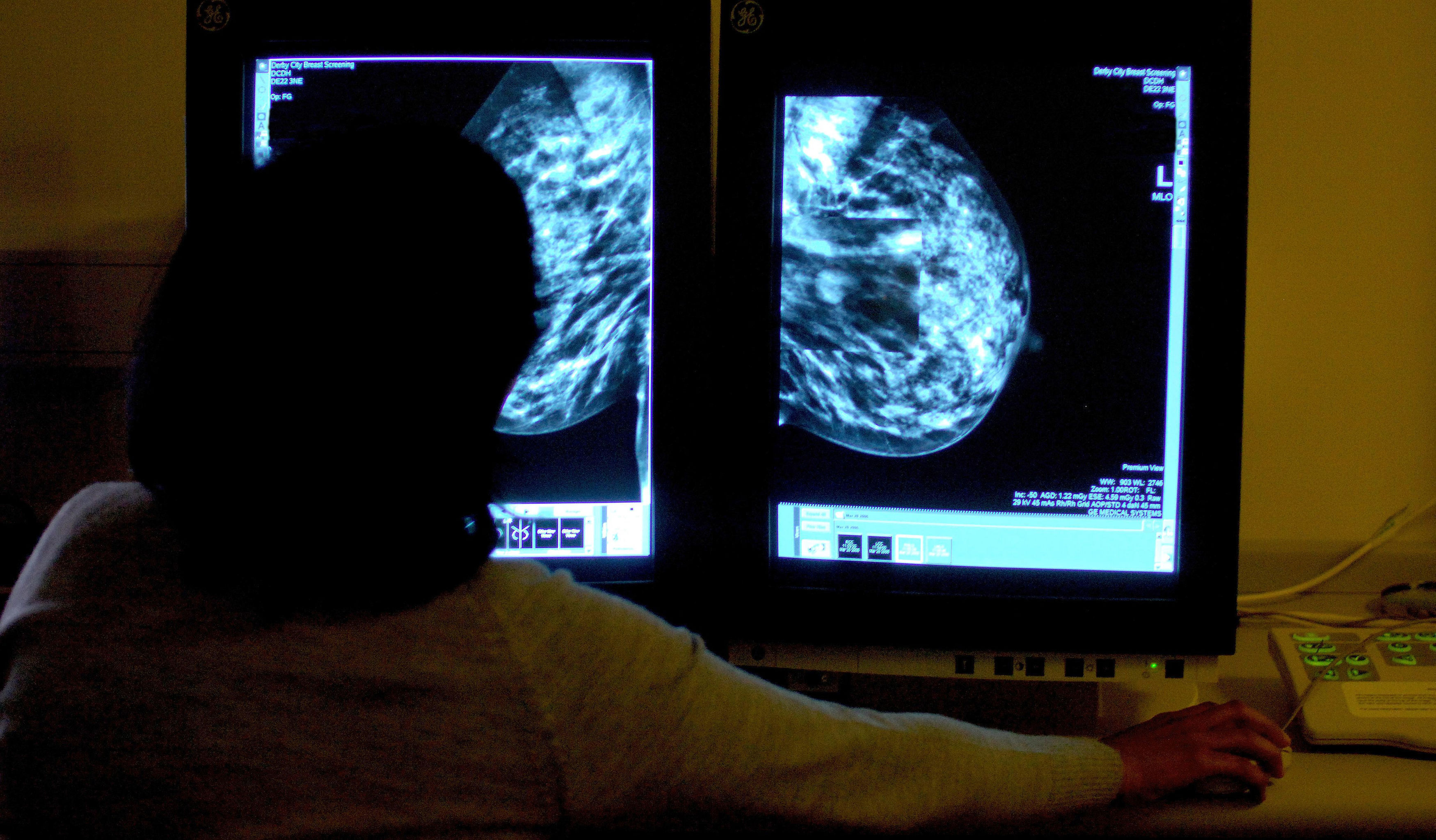 Hundreds of thousands of women were not invited for routine breast cancer screening due to an administrative error, it has been reported (Rui Vieira/PA Wire)