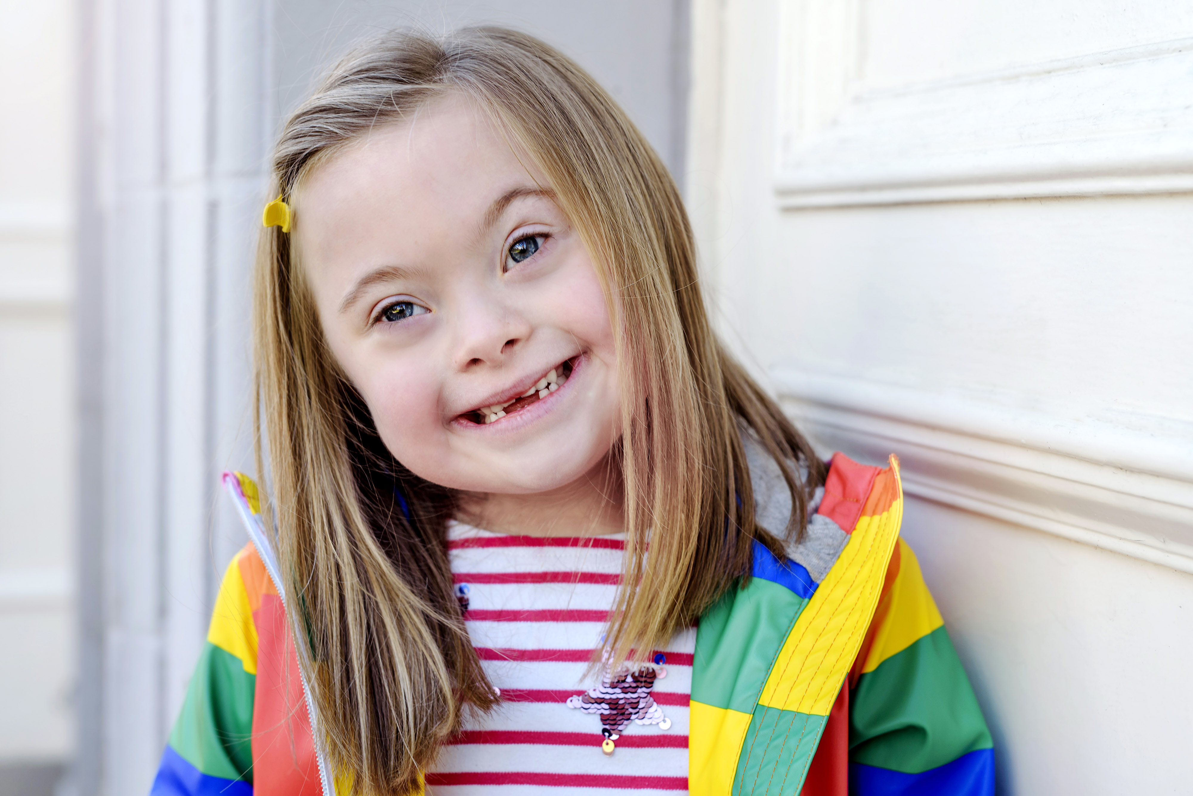 Ciara Burns, age 6 yrs. Ciara was born with Down Syndrome.