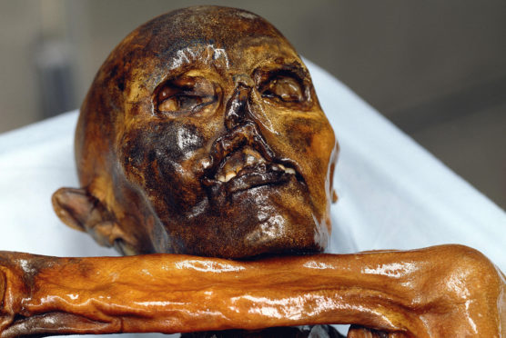 A 5,300-year-old mummified corpse, known as Otzi, found in the Alps