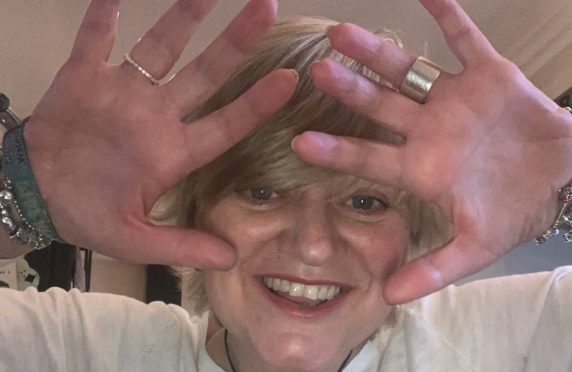 Cor celebrates the first anniversary of her hand transplant