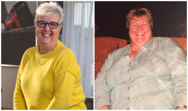 Doreen was a size 20 before the surgery which changed her life in 2008