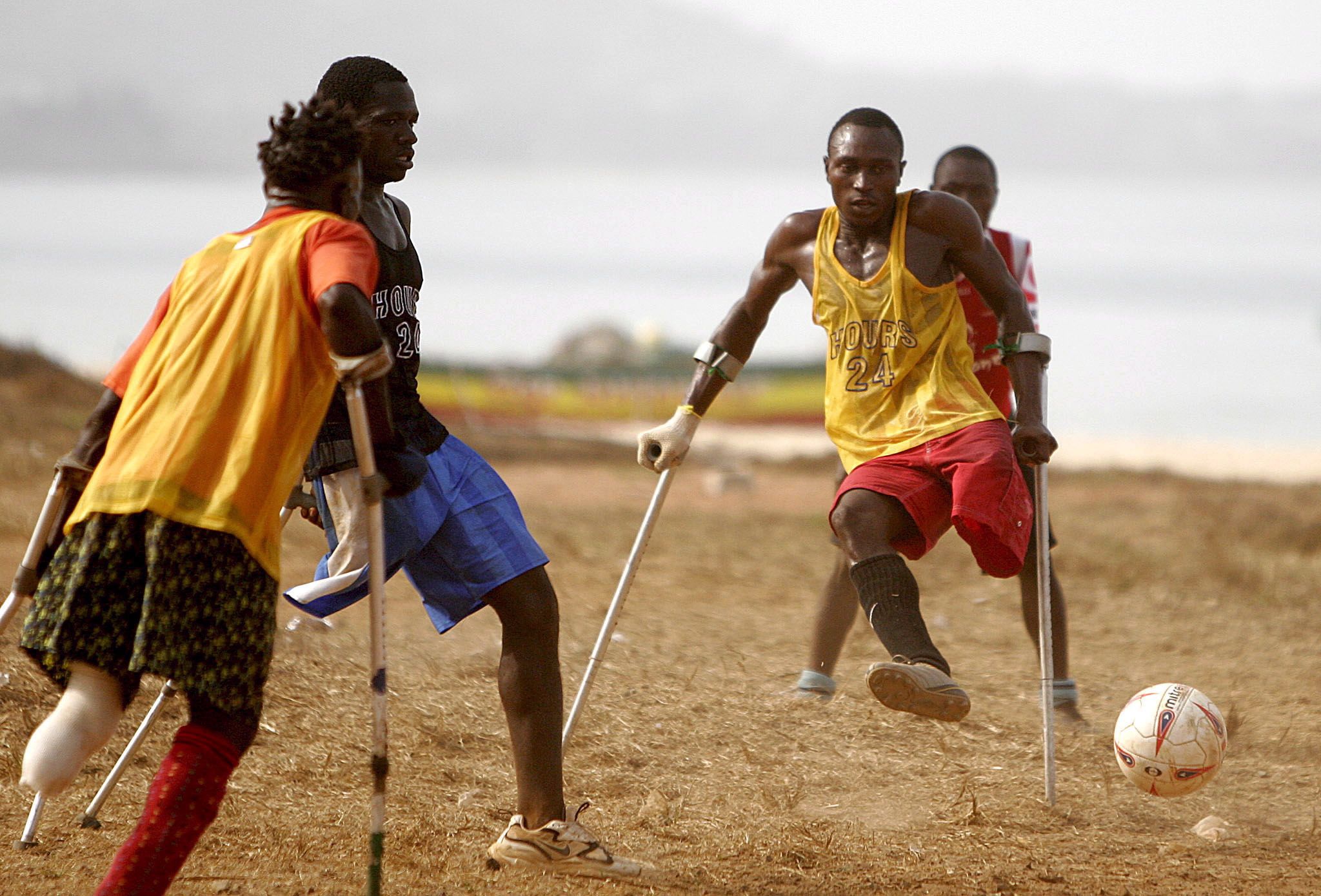 Amputee players on Lumley Beach, Freetown, Sierra Leone