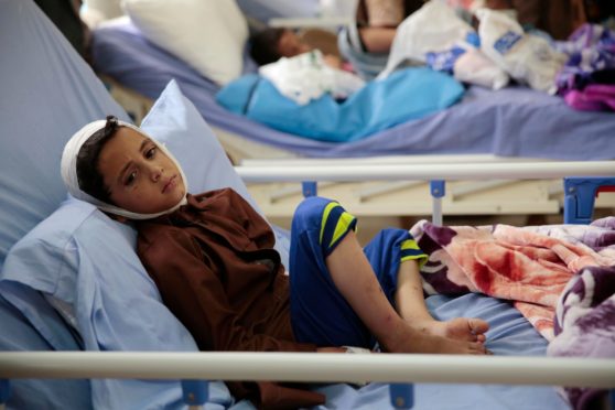 A boy hurt in 2018 bombing of bus in Yemen