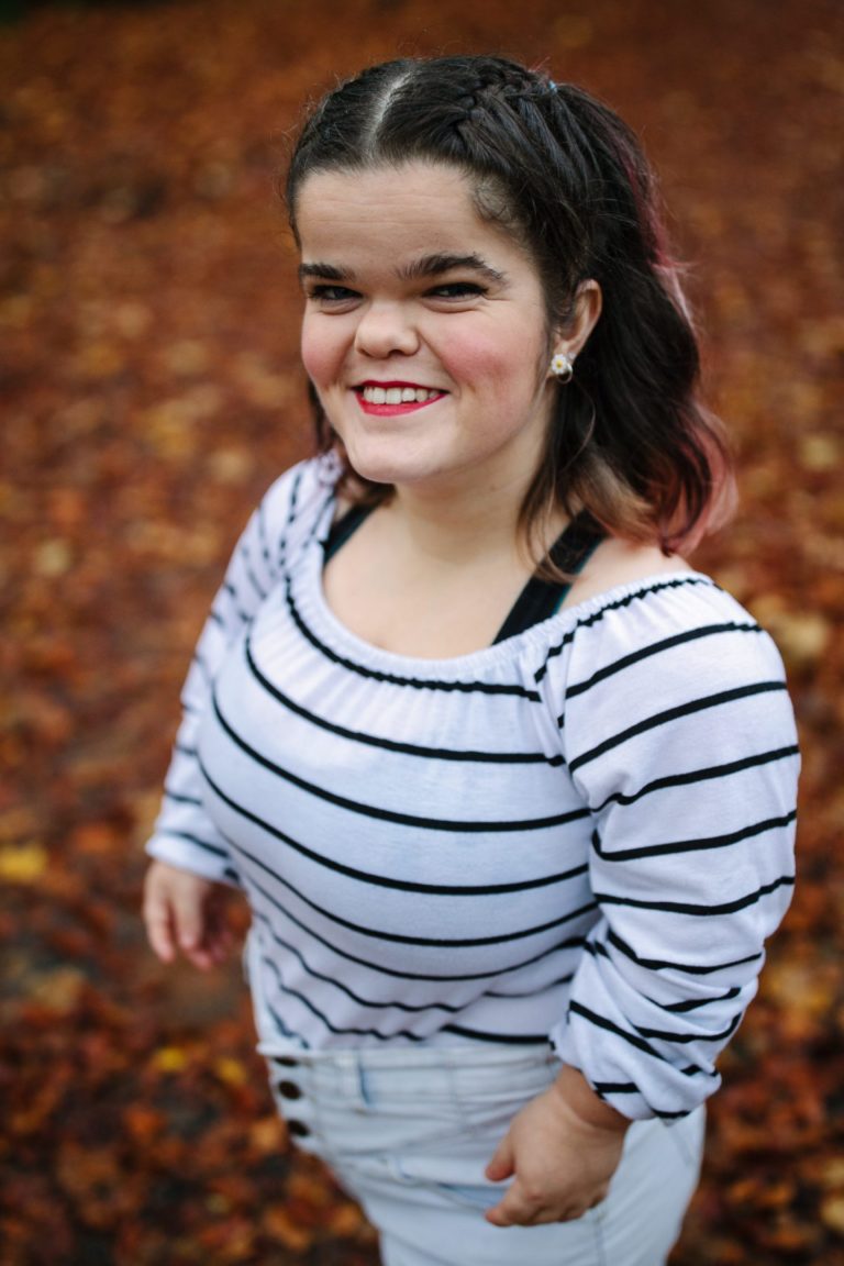 Actress Abbie Purvis on battle to beat stereotypes of disability and ...