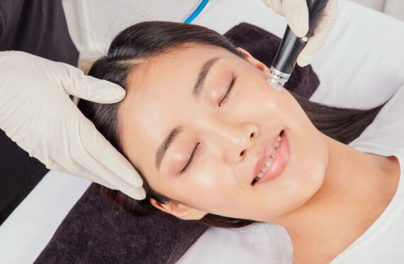 Hydrafacial gives your skin a deep cleanse