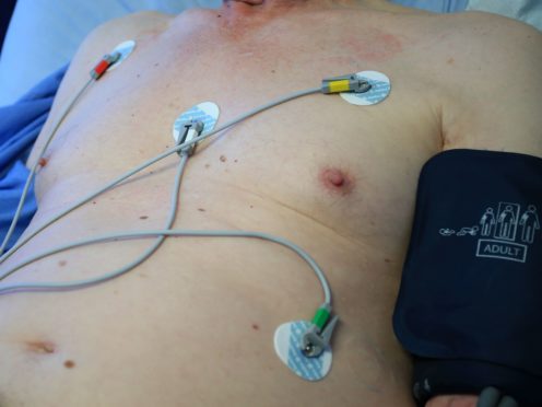 Heart disease patients will be treated five times faster using new 3D technology being rolled out on the NHS (Peter Byrne/PA)
