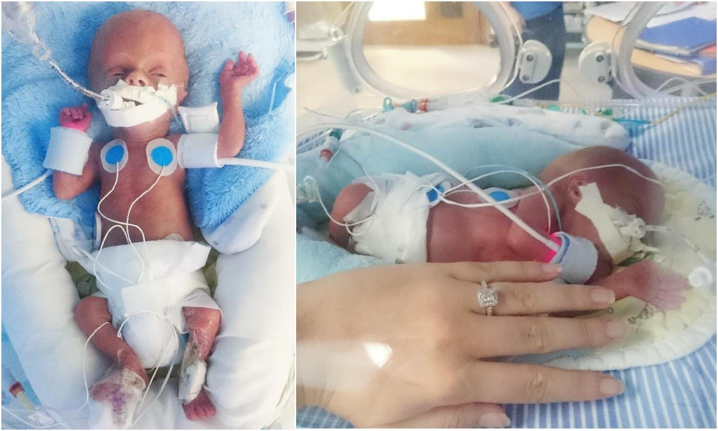 Henry spent five months "battling to survive" in hospital after he was born.