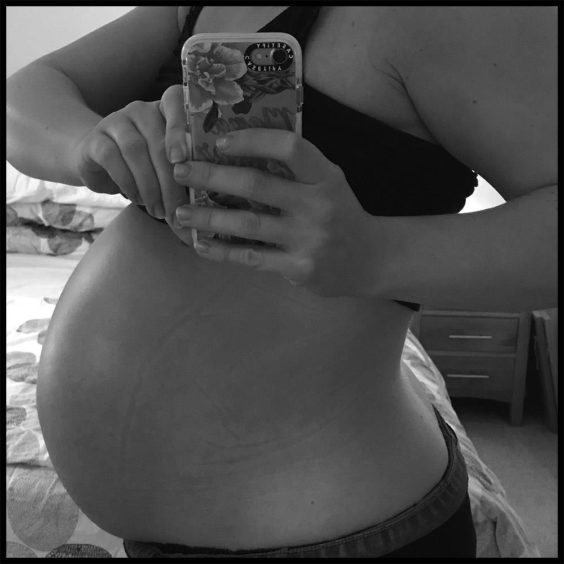 Image of Louise Dredge pregnant