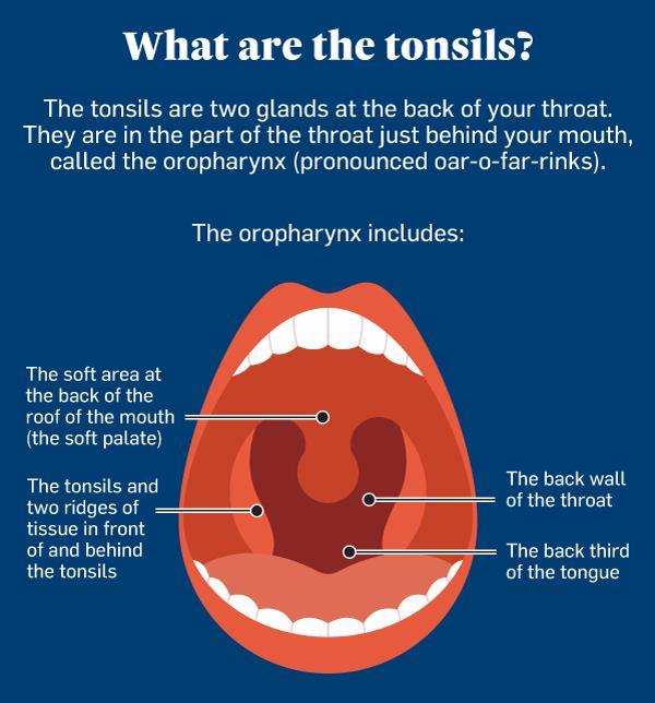 A diagram labels parts of the mouth where the tonsils are