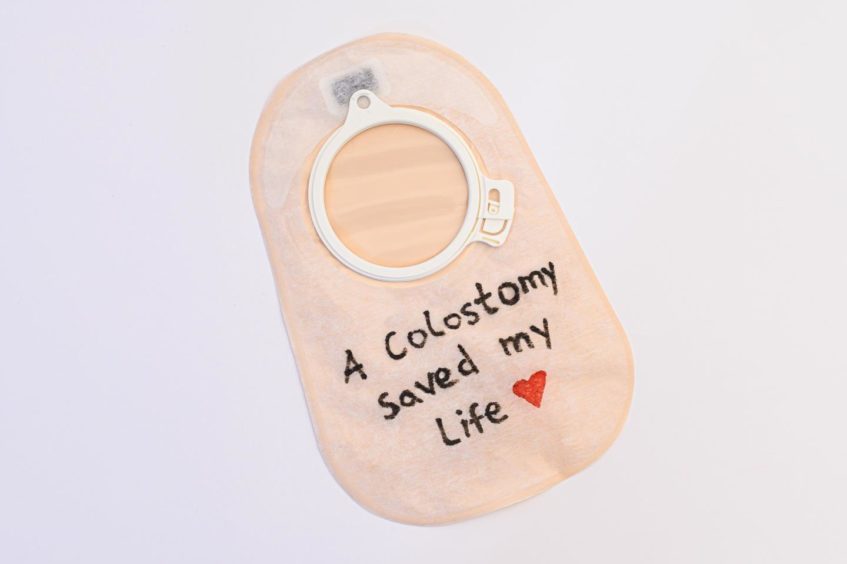 A stoma bag with the words 'a colostomy saved my life' written on it