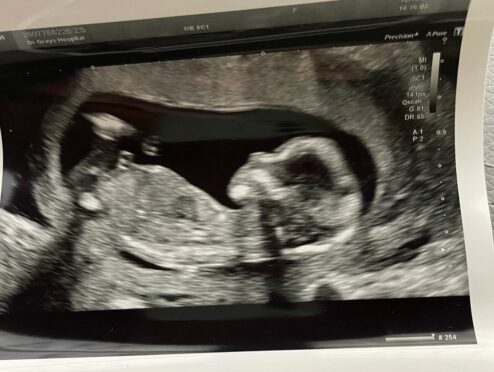 A scan photo of Baby Sullivan