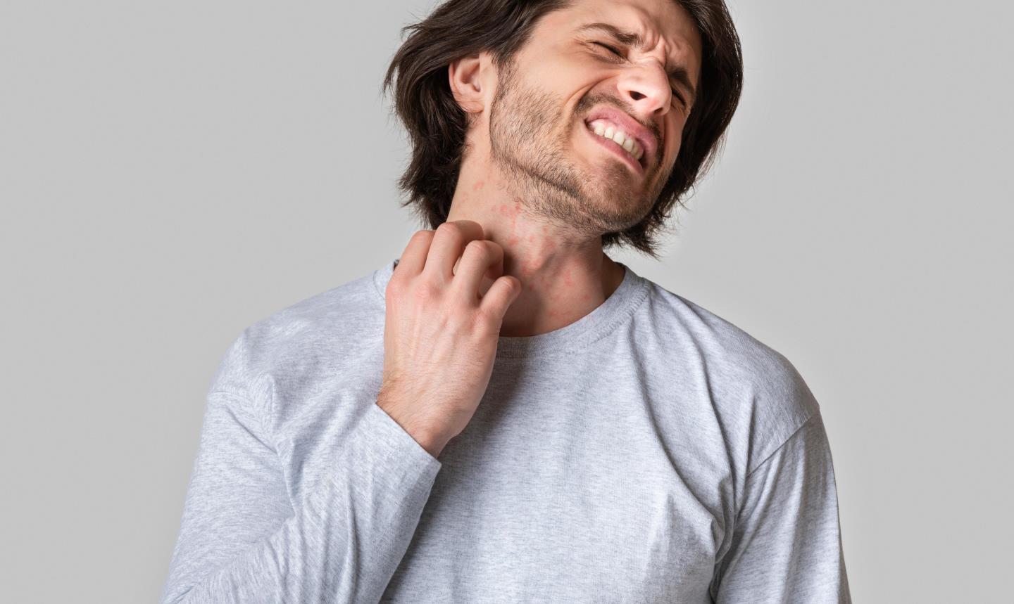A man scratches his neck. GPs can provide medication to ease some symptoms, such as itchy skin.