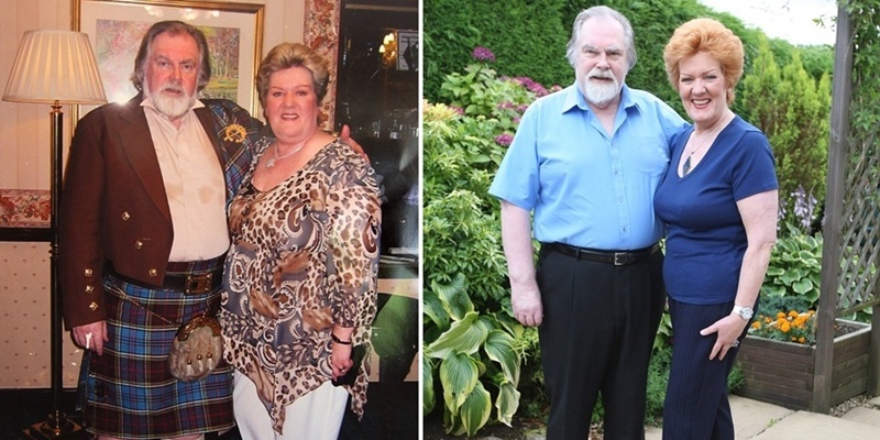 Kris Miller, Courier, 15/08/11. Picture today shows Diane Henderson with husband Tony in which Diane was at her heaviest. Diane has lost 7stone through a healthy eating plan.