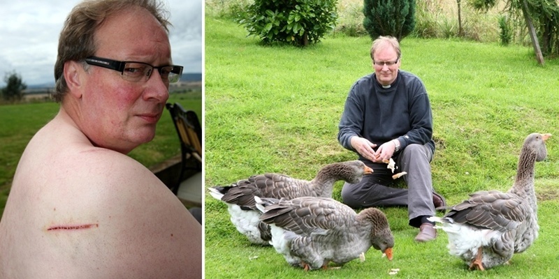Steve MacDougall, Courier, Upper Greenside, between Abernethy and Newburgh. Picture to accompany story about the Very Rev'd Hunter B Farquharson, recovering after being attacked by a Sea Eagle while trying to protect his geese. Pictured, the wound below his shoulder.