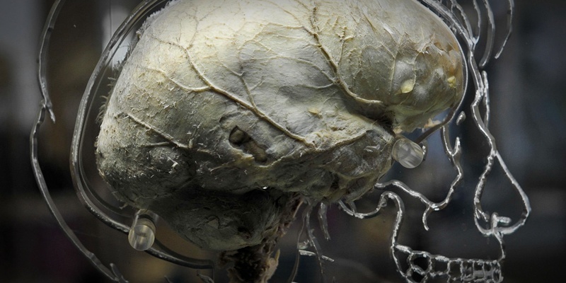A real human brain suspended in liquid with a to-scale skeleton, central nervous system and human silhouette carved into acrylic, inside the @Bristol science attraction as part new exhibition called 'All About Us' which will open to the public on Friday 11th March.