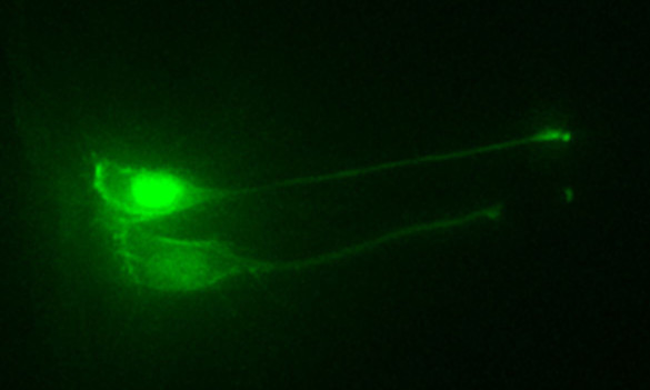 Two newborn neurons shedding their tip ends, or abscising.