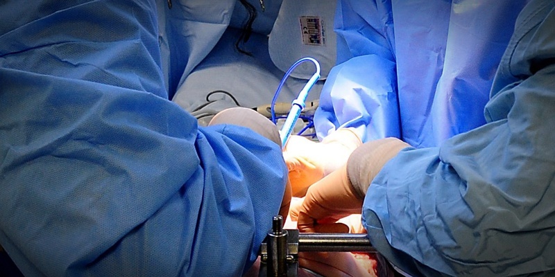 File photo dated 07/04/11 of a general view of an operation in a hospital. Surgery may be leading to twice as many hospital deaths in Europe as has been assumed, a study has shown.