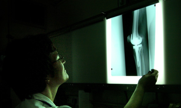 X-ray dept, Royal Orthopedic Hospital, Oswestry. Picture David Jones/PA